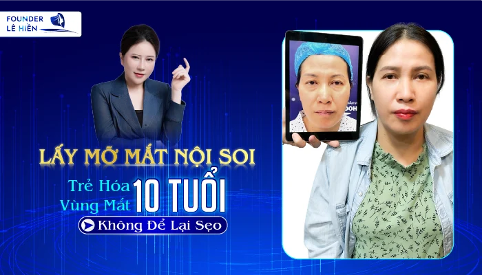 Lay Mo Mat Noi Soi 01