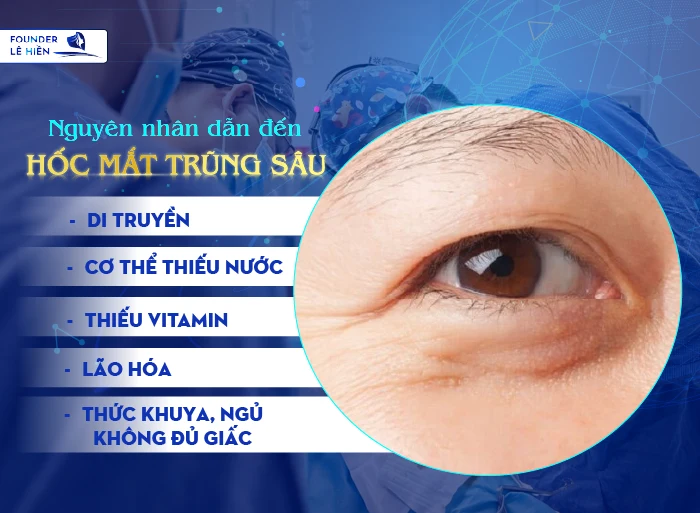 Tái tạo mỡ mắt