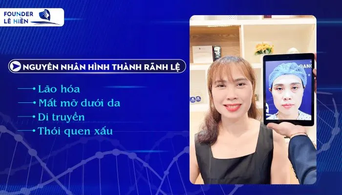 xóa rãnh lệ