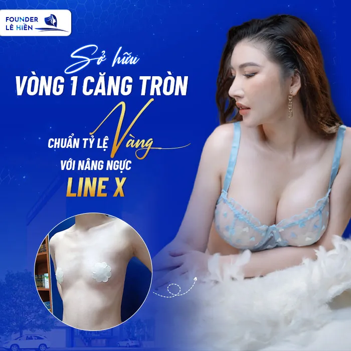 nâng ngực Line X