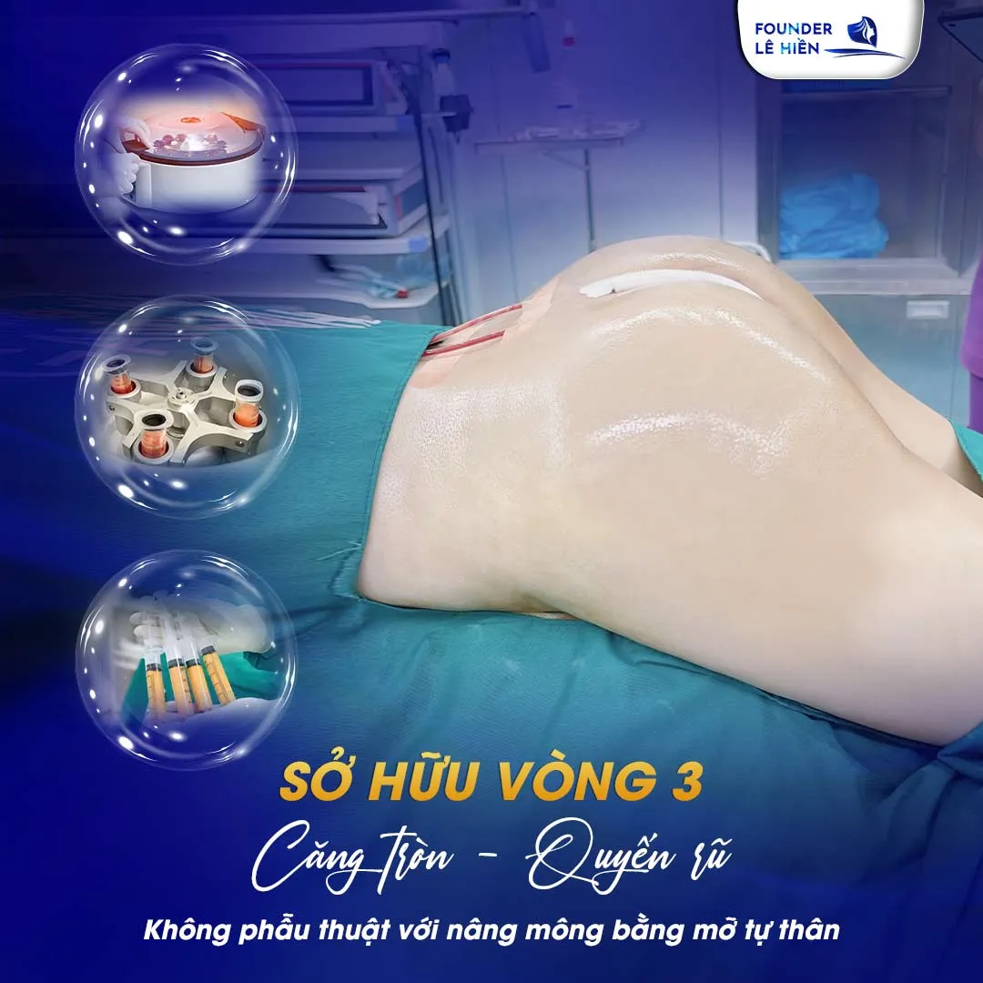 Nâng mông bằng mỡ tự thân