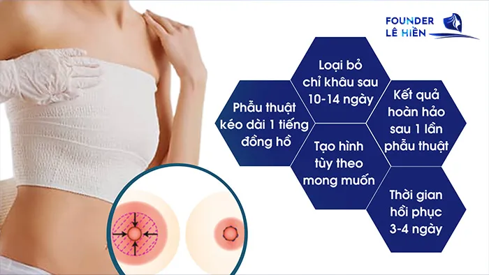 Thu nhỏ quầng vú hai bên