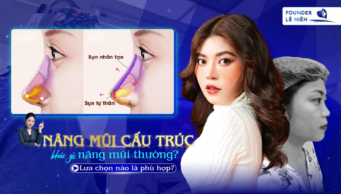 nang mui cau truc khac gi nang mui thuong 2