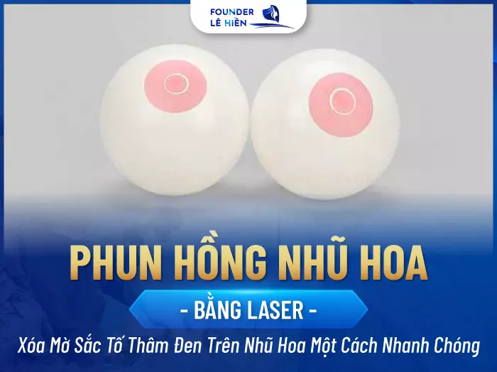 Phun hồng nhũ hoa laser là công nghệ thẩm mỹ được giới chuyên gia đánh giá cao trong ngành thẩm mỹ hiện nay. 