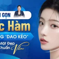 thon-gon-goc-ham (1)