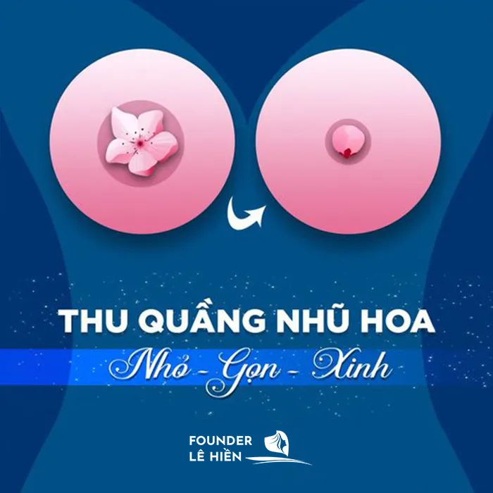 Thu nhỏ quầng vú hai bên