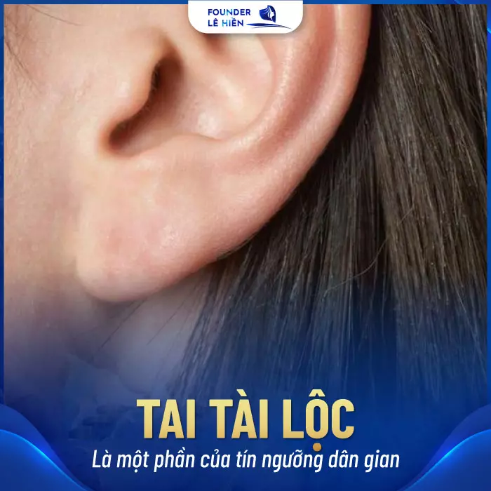 Tiêm Filler Tai Tài Lộc - Tai Đẹp Chuẩn Phong Thủy, Phát Tài Phát Lộc 2 Tai tài lộc là loại tai có vành tai cao hơn chân mày, tai to, dày, dài và có màu sắc tươi sáng