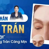 xoa-nhan-co-tran (2)