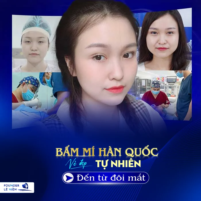 Bấm mí Hàn Quốc