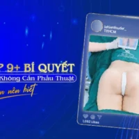 Bí Quyết Nâng Mông Không Cần Phẫu Thuật Bạn Nên Biết-01