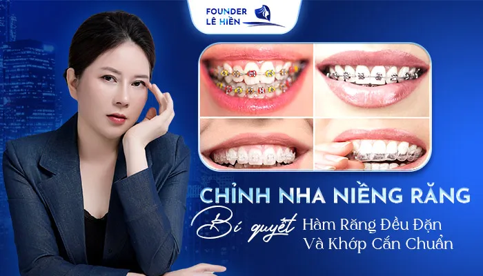 CHINH NHA 26 3