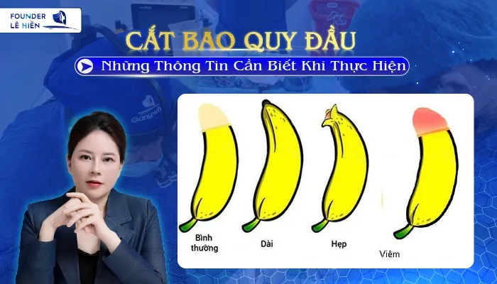 Cắt Bao Quy Đầu: Những Thông Tin Cần Biết Khi Thực Hiện