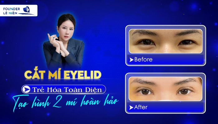 Cat Mi Eyelid 01 1