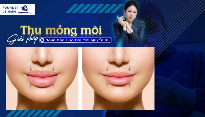 Hoan Hao Cho Doi Moi Quyen Ru 01