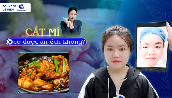 Cắt mí có được ăn ếch không? 4 nguyên nhân cần kiêng thịt ếch