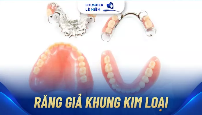 Phục hồi tháo lắp răng giả