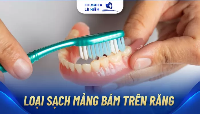 Phục hồi tháo lắp răng giả