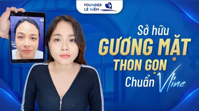 Những Điều Cần Biết Khi Phẫu Thuật Gọt Hàm