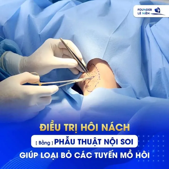 Điều trị hôi nách bằng phẫu thuật