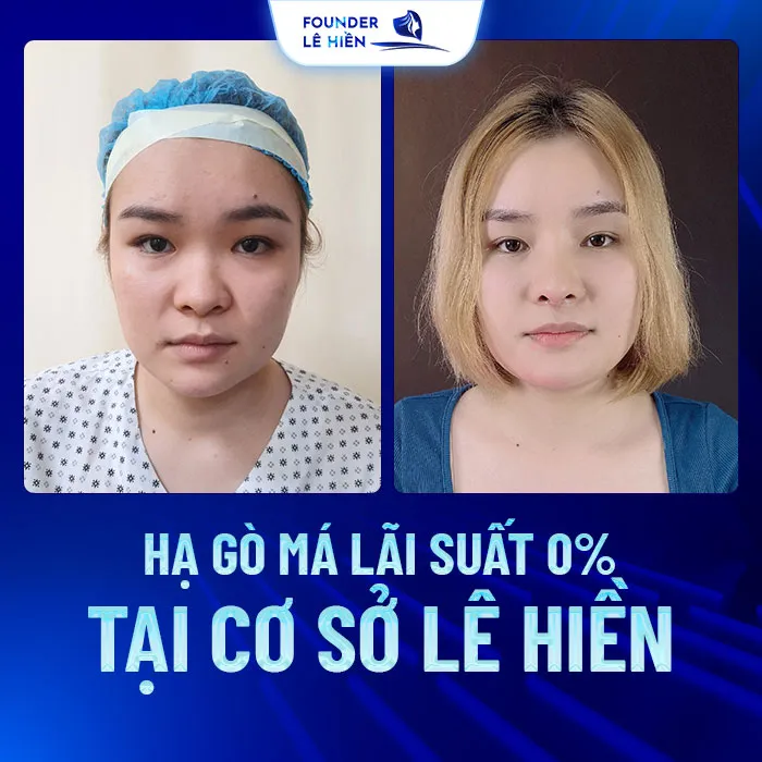 Ha go ma lai suat 0 tai co so Le Hien 8