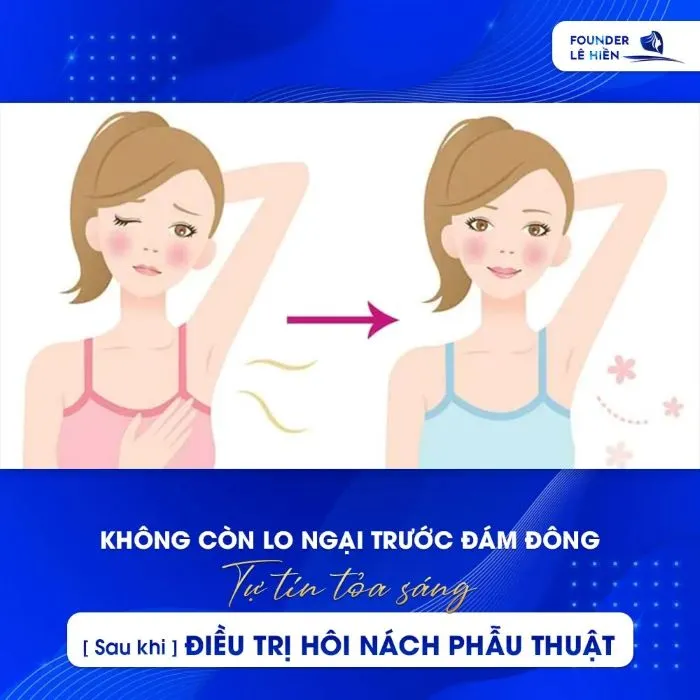 Điều trị hôi nách nách phẫu thuật