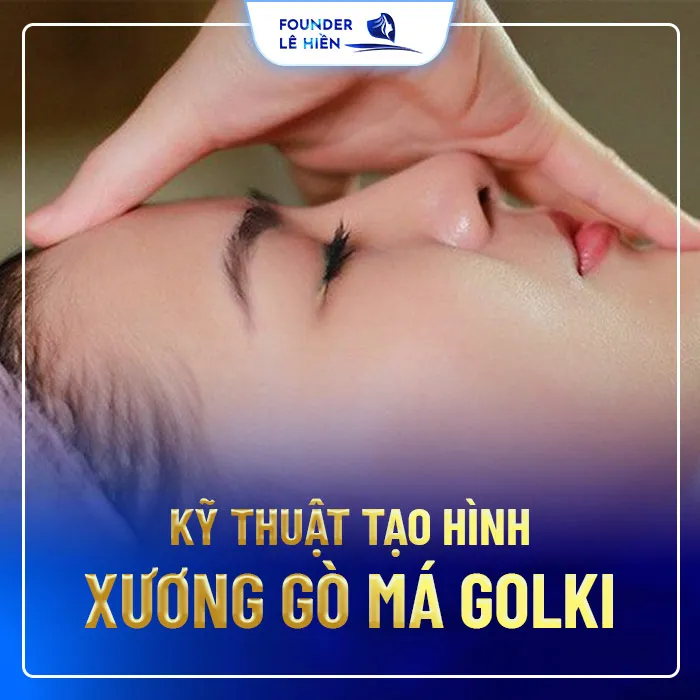 Hạ Gò Má Không Cần Phẫu Thuật