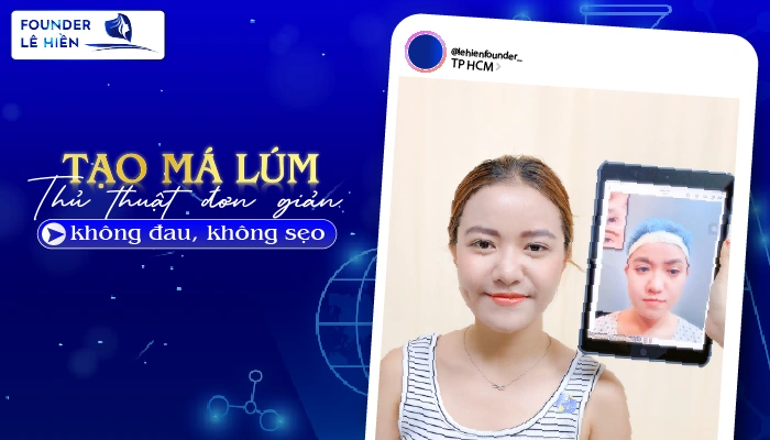 Tạo Má Lúm Đồng Tiền