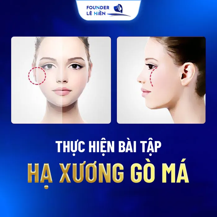 Hạ Gò Má Không Cần Phẫu Thuật