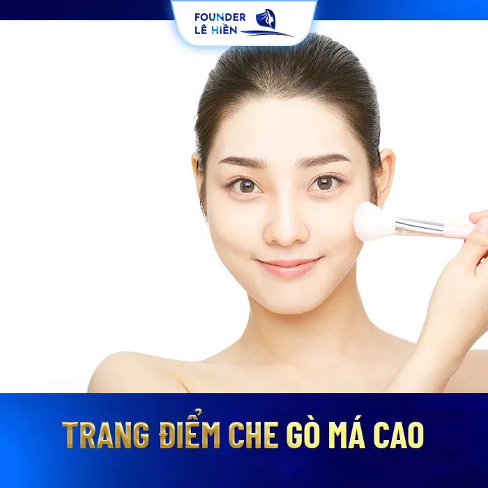 Hạ Gò Má Không Cần Phẫu Thuật