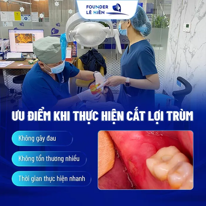 Cắt Lợi Trùm Cho Răng Khôn