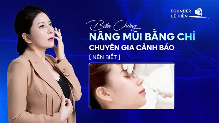 bien chung khi nang mui bang chi