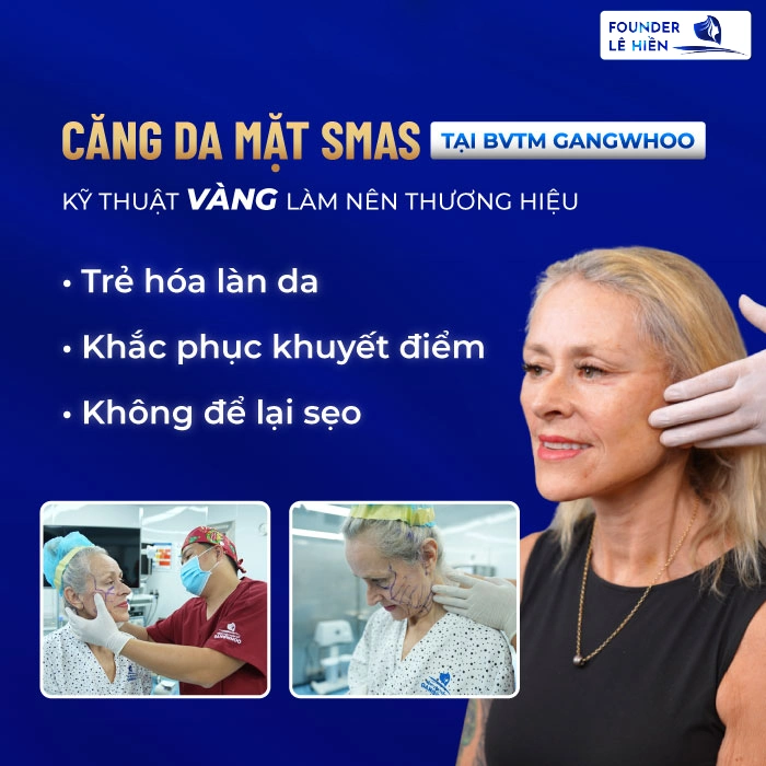 Phương Pháp Căng Da Mặt Chảy Xệ SMAS - Khắc Phục Da Chảy Xệ Nặng, Mất Đàn Hồi Và Nhão Rõ Rệt