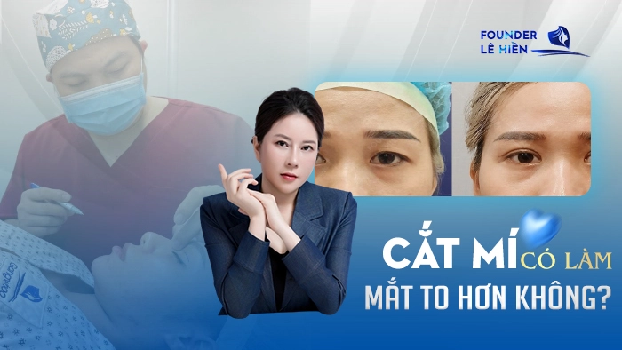 Cắt Mí Có Làm Mắt To Hơn Không?