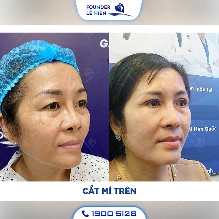 cat mi khi ve gia3