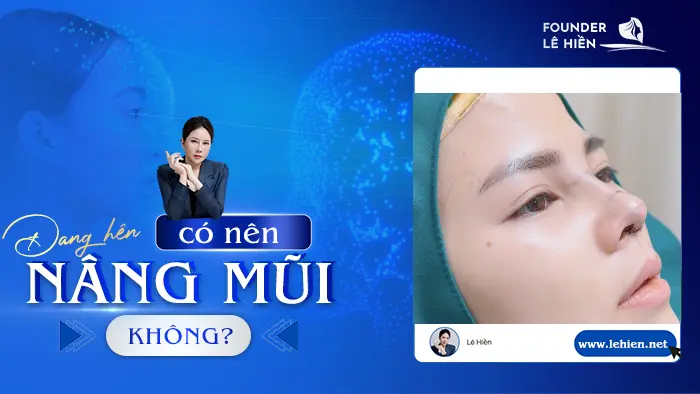 dang hen co nen nang mui khong