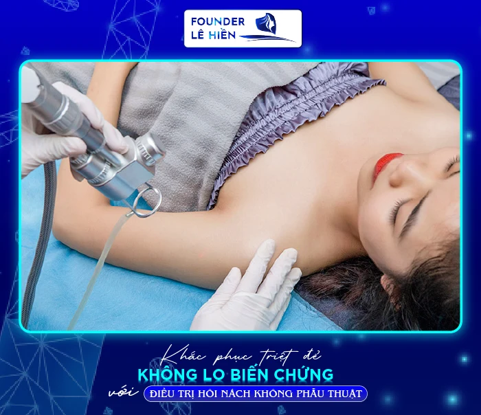 điều trị hôi nách không phẫu thuật