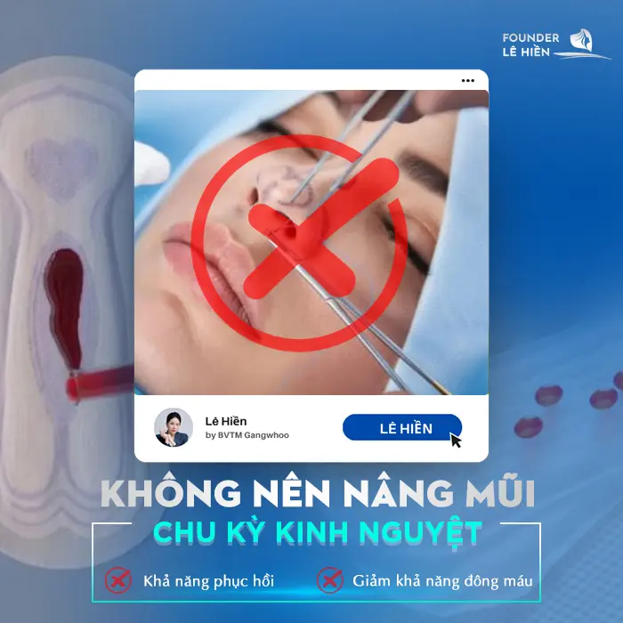Có Kinh Có Nâng Mũi Được Không? 5 Nguyên Tắc Vàng Nên Biết 2 Có Kinh Có Nâng Mũi Được Không