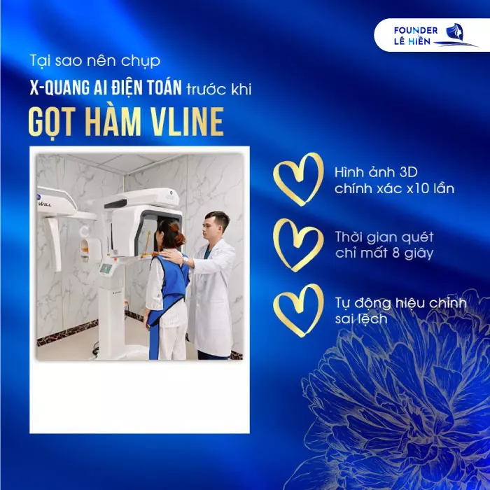 Gọt Hàm Bị Lệch