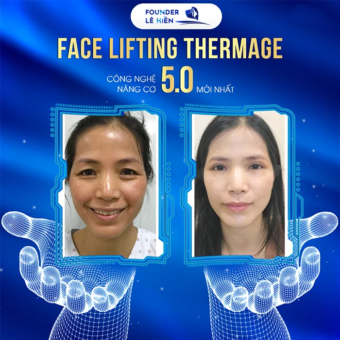 mat na cang bong da6