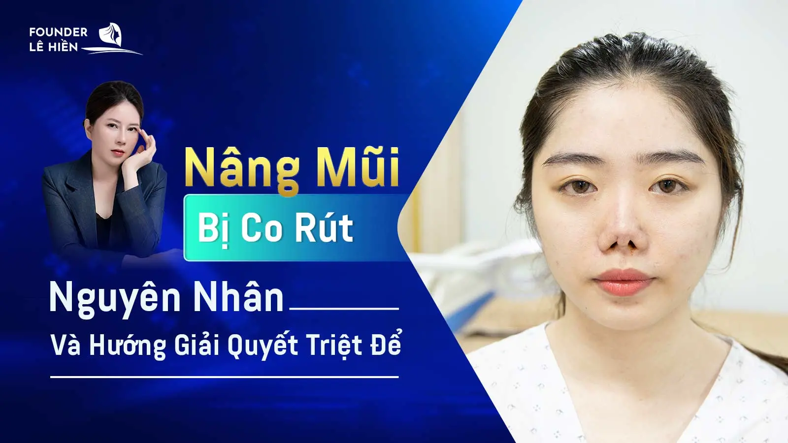 nang mui bi co rut