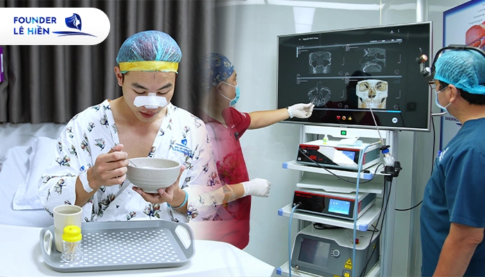 Nâng mũi có đánh răng được không? 4 bước vệ sinh mũi bạn cần nắm rõ 4 Một số lưu ý nhỏ về chế độ ăn uống và sinh hoạt