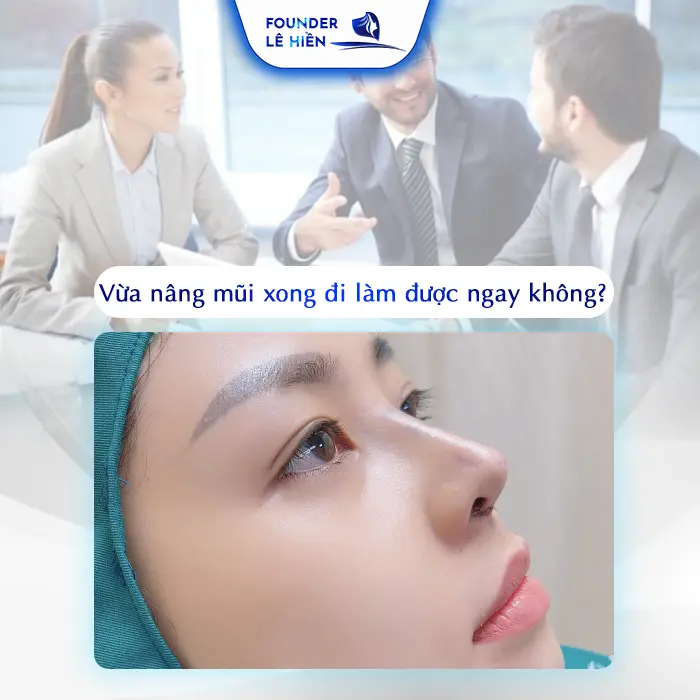Nâng Mũi Bao Lâu Thì Đi Làm Được Mà Không Ảnh Hưởng Đến Kết Quả 1 Nâng Mũi Bao Lâu Thì Đi Làm Được