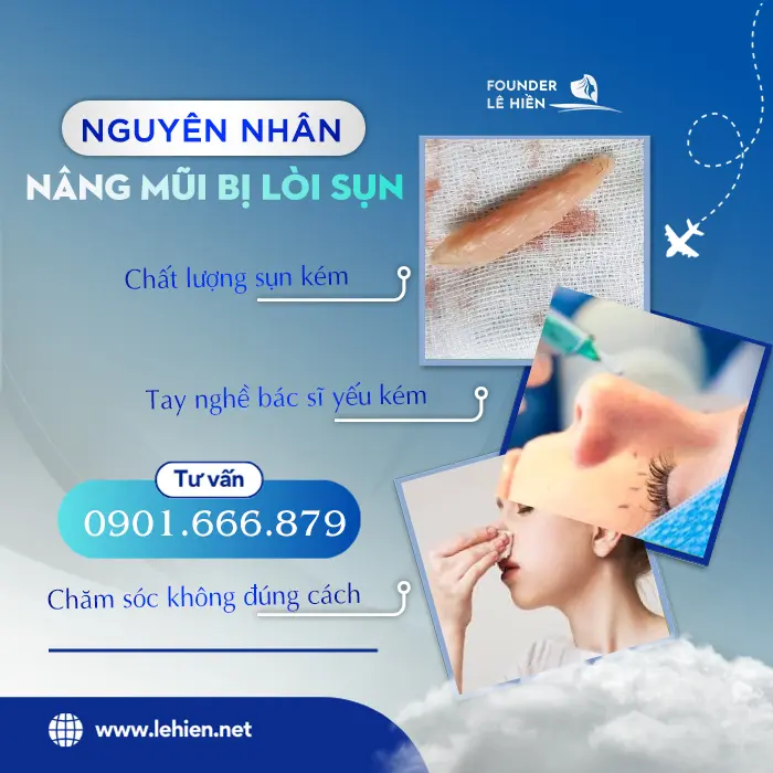 Nâng Mũi Bị Lòi Sụn