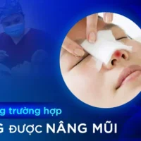 nhung-truong-hop-khong-duoc-nang-mui