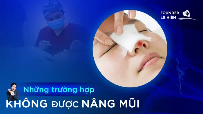 Những Trường Hợp Không Được Nâng Mũi