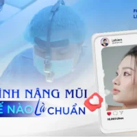 quy-trinh-nang-mui-nhu-the-nao