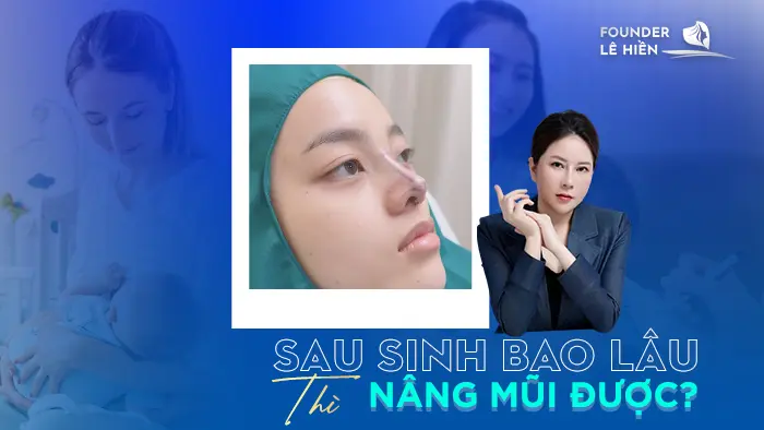 Sau Sinh Bao Lâu Thì Nâng Mũi Được