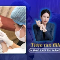 tiem-tan-filler-bao-lau-thi-nang-mui-duoc