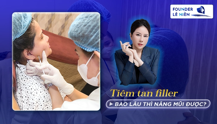 Tiêm Tan Filler Bao Lâu Thì Nâng Mũi Được? 1 Tiêm tan filler bao lâu thì nâng mũi được?