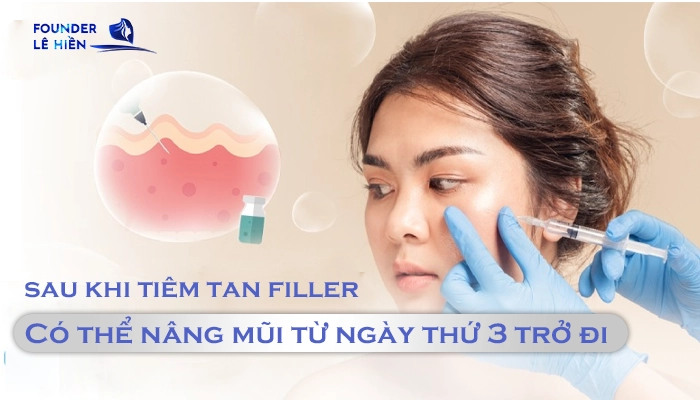 Tiêm Tan Filler Bao Lâu Thì Nâng Mũi Được? 3 Giải đáp: Tiêm Tan Filler Bao Lâu Thì Nâng Mũi Được